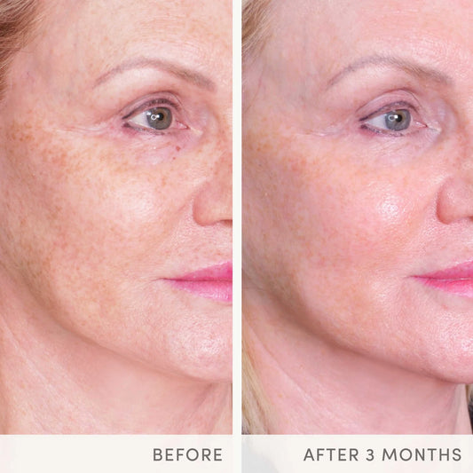 Advanced Nutrition Programme - Skin Ultimate Supplements